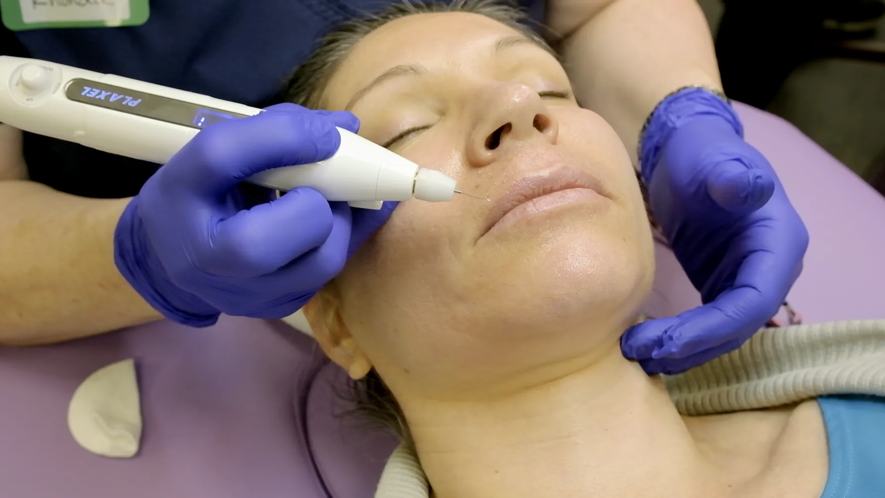 In-Person Plasma Pen Training