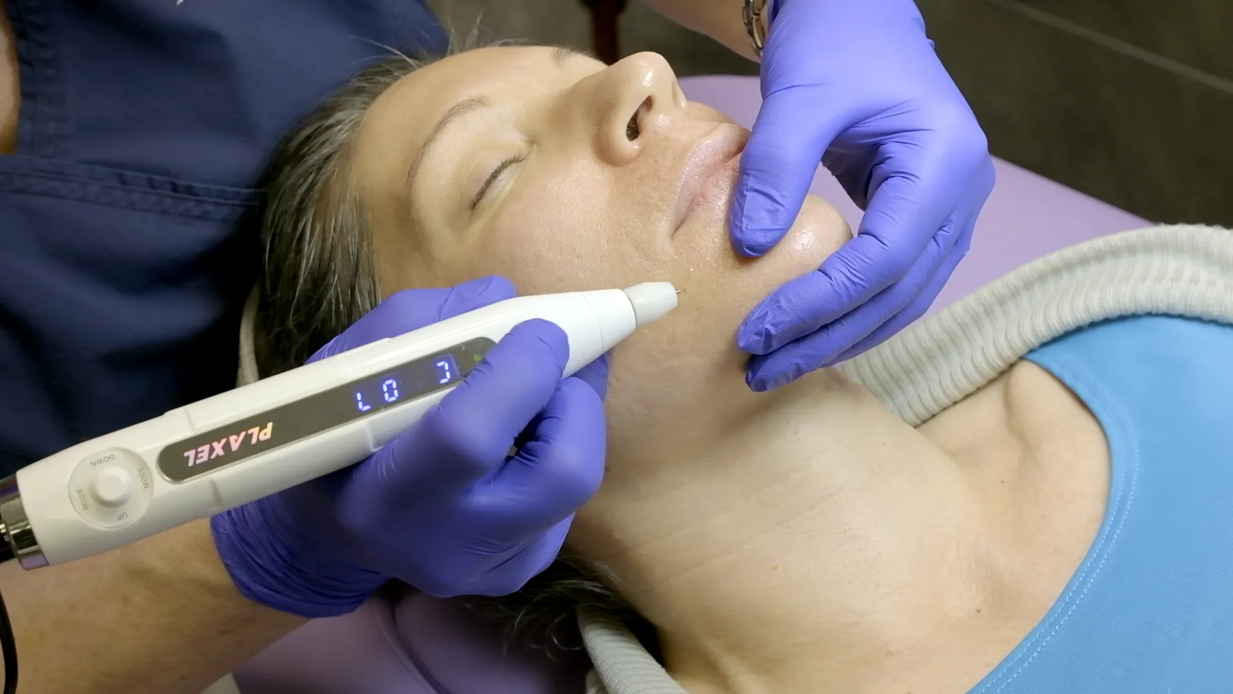 In-Person Plasma Pen Training